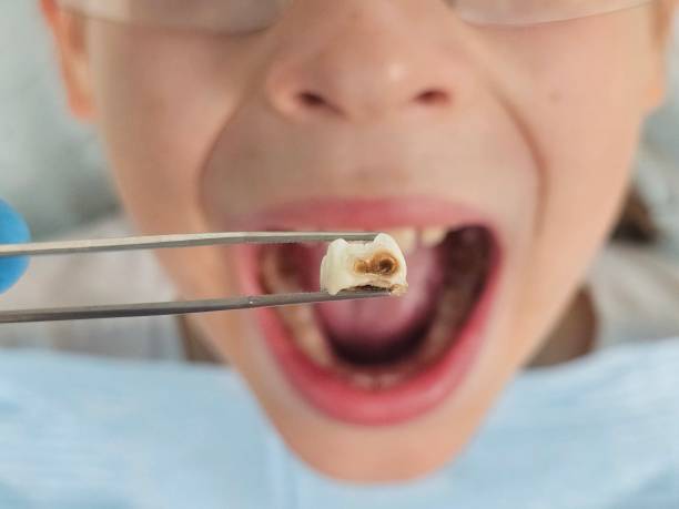Best Walk-In Emergency Dentist in Lake Of The Woods, IL